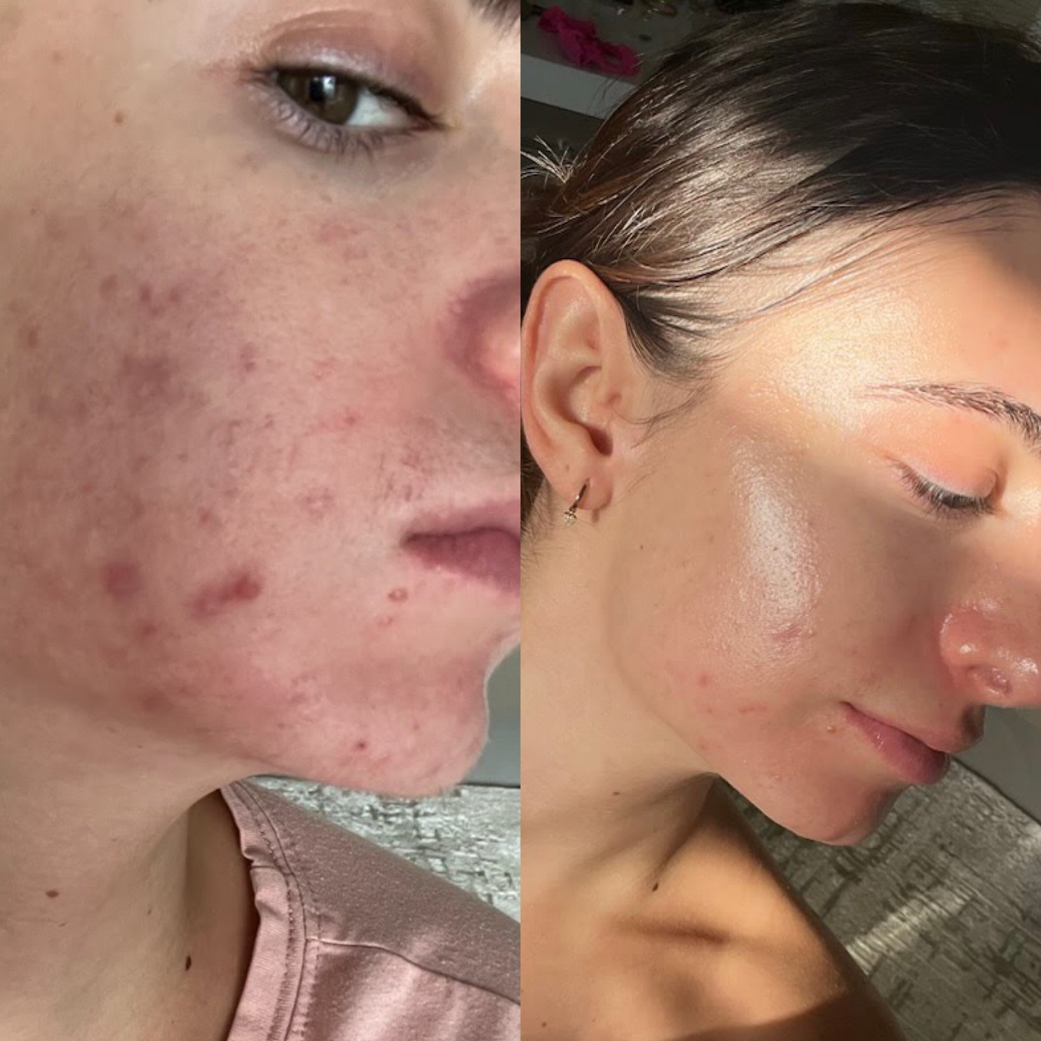 unnamed image